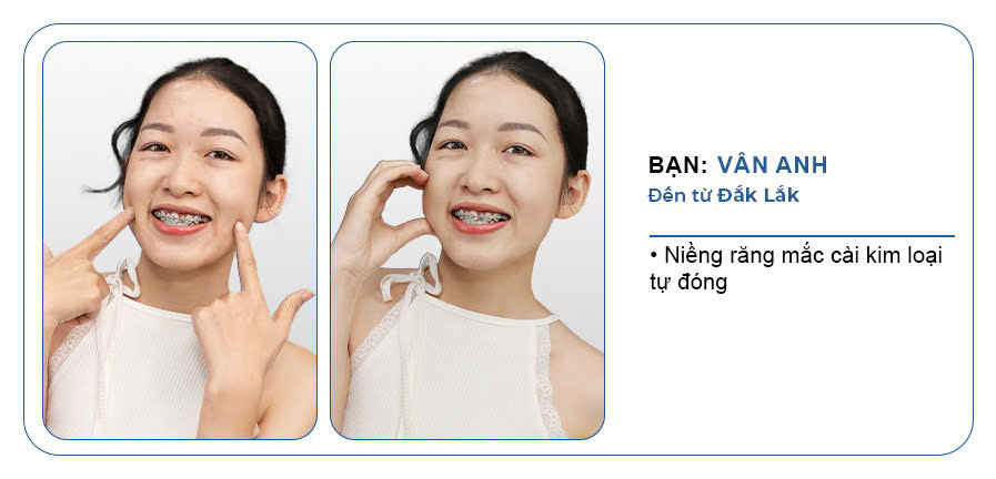 MS. VAN ANH