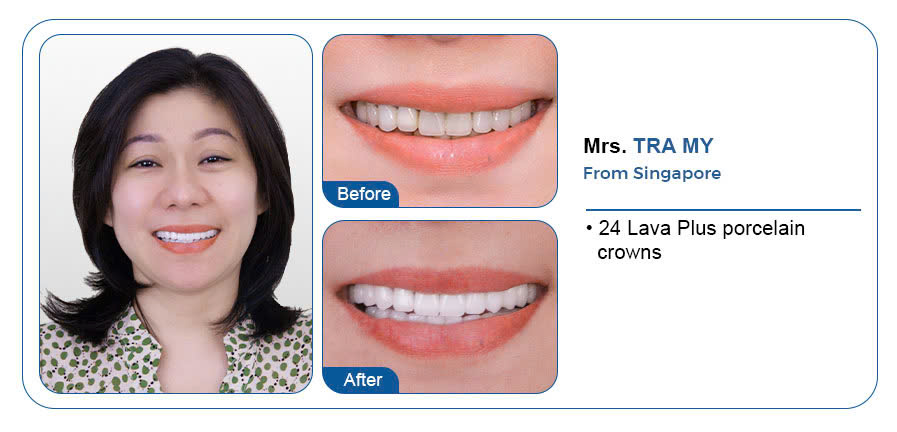 MRS. TRA MY